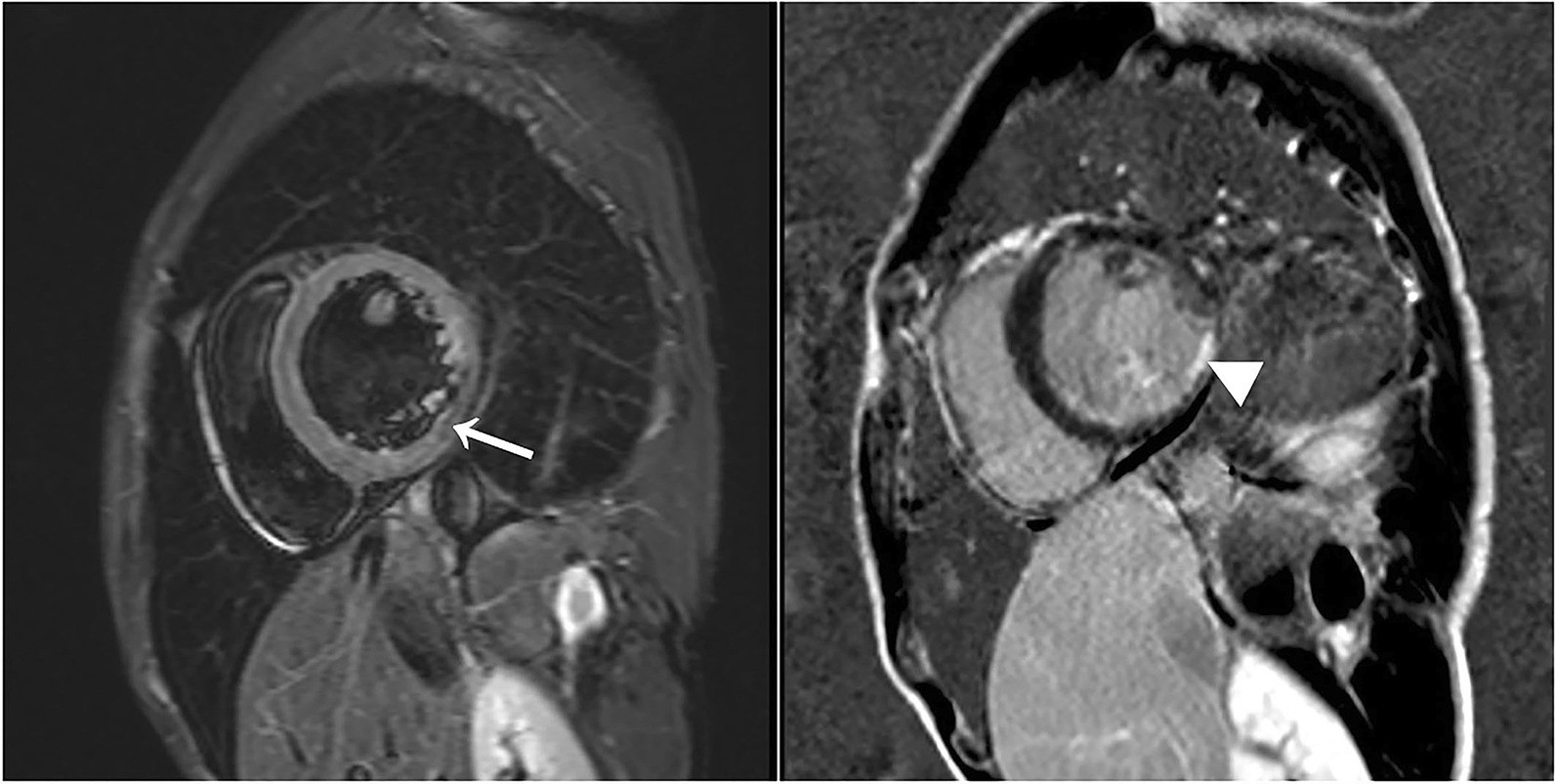 Fig. 6