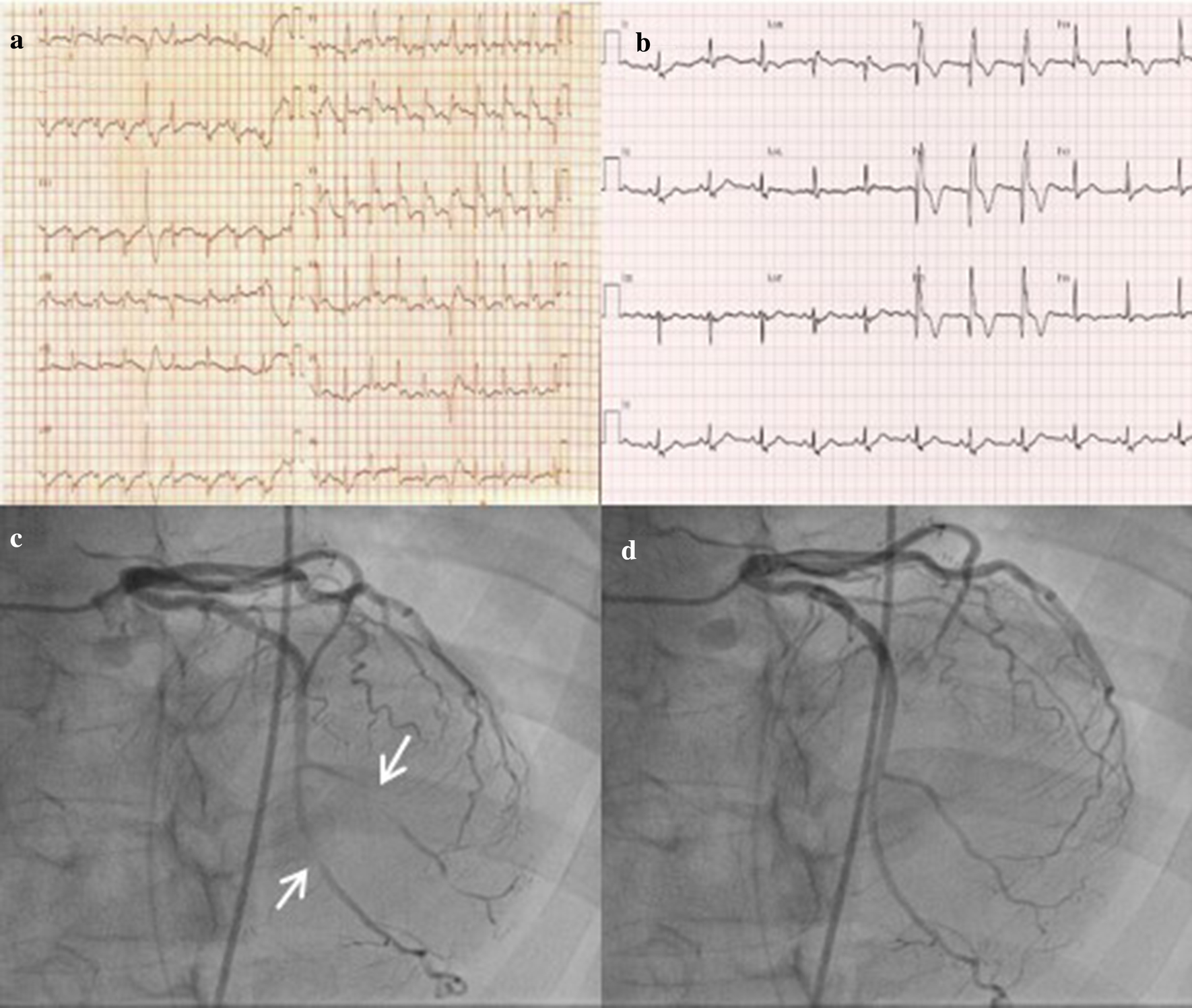 Fig. 1