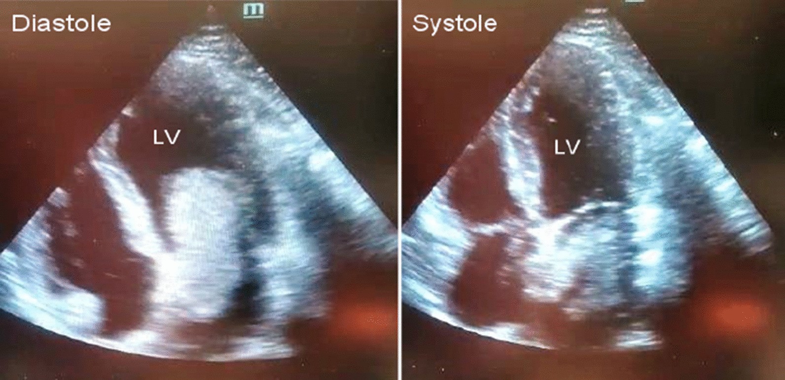 Fig. 2