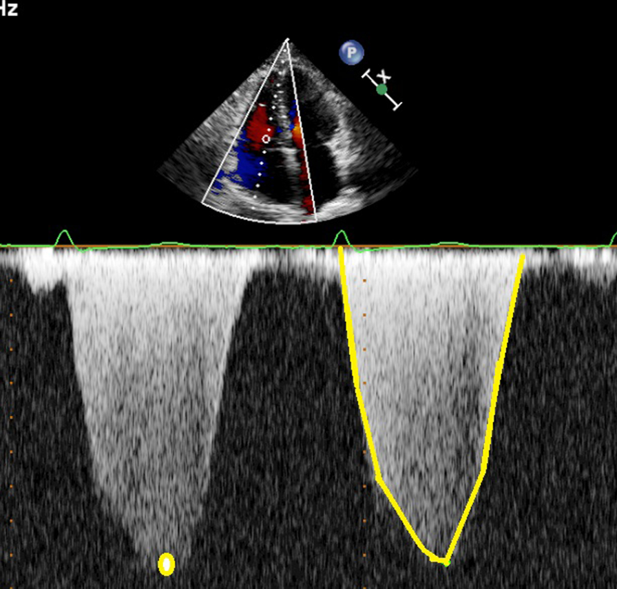 Fig. 1