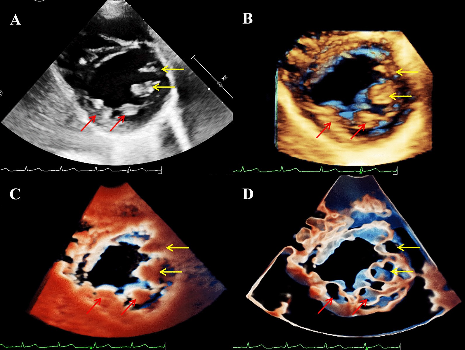 Fig. 2