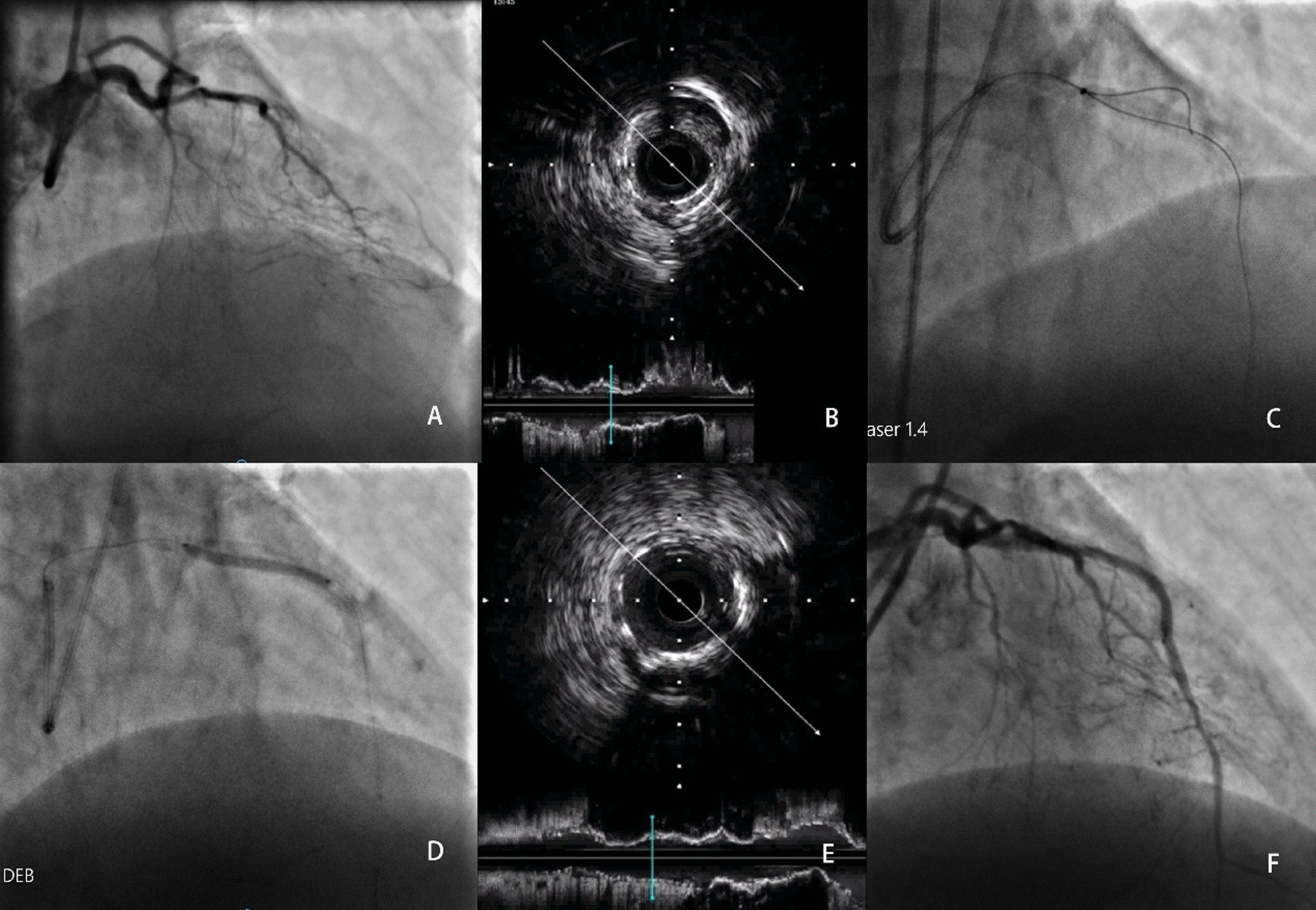 Fig. 3