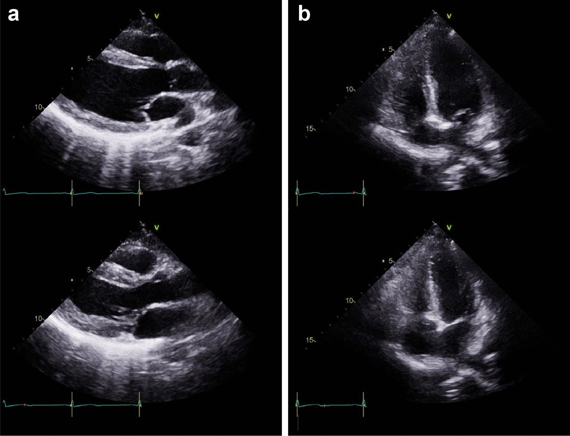 Fig. 4