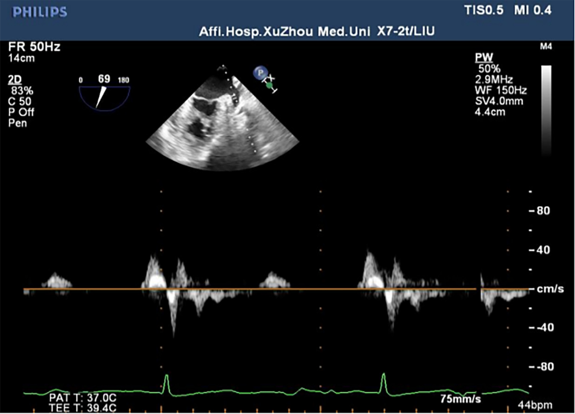 Fig. 2