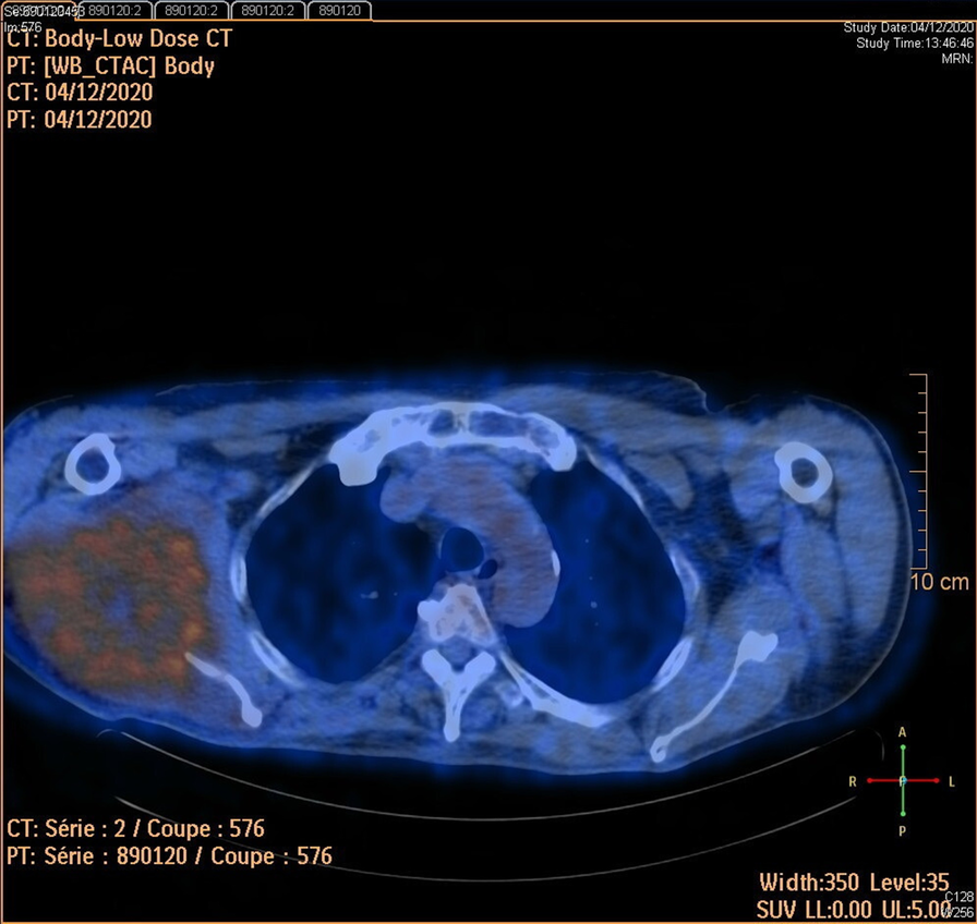 Fig. 2