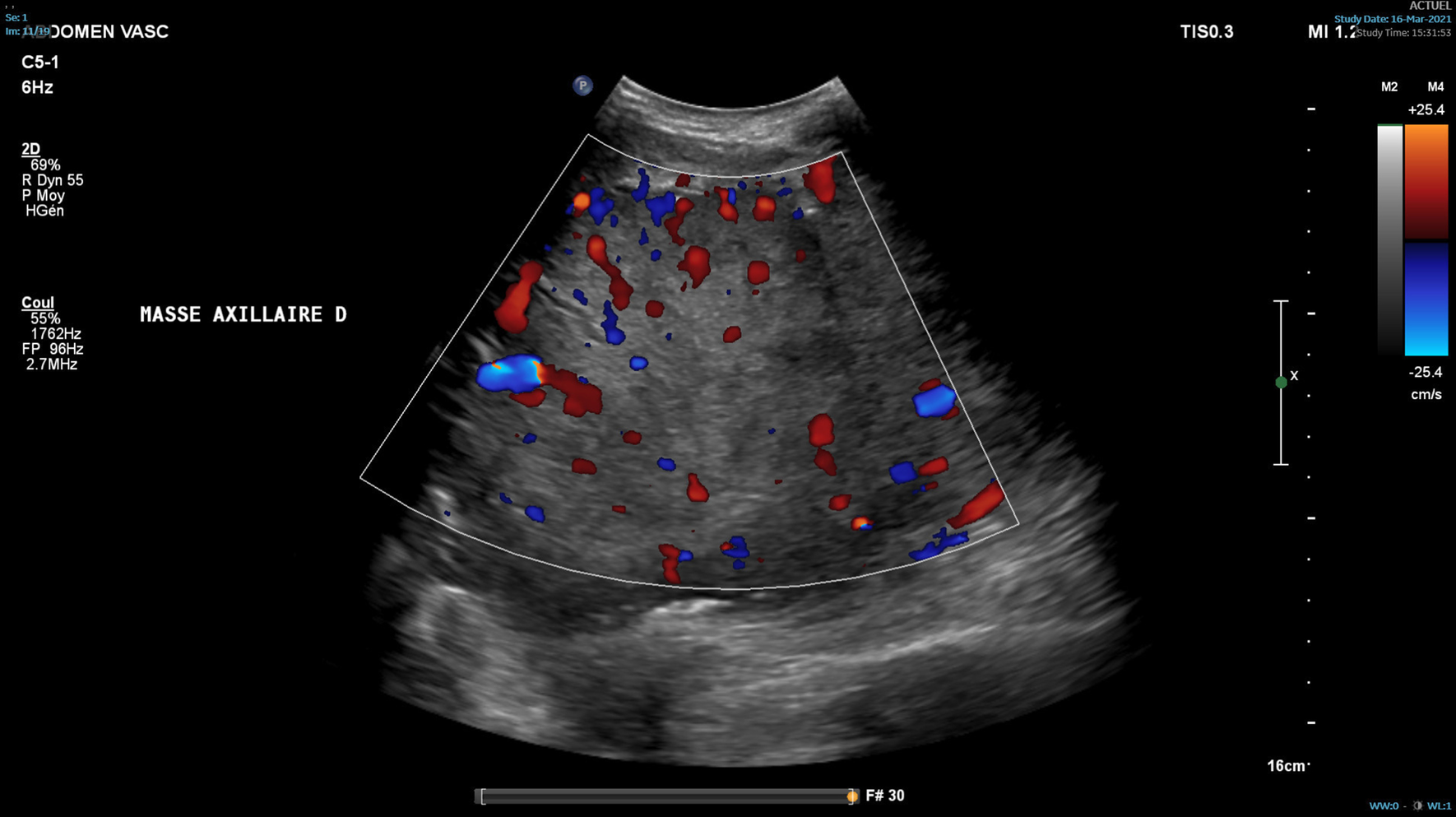 Fig. 6