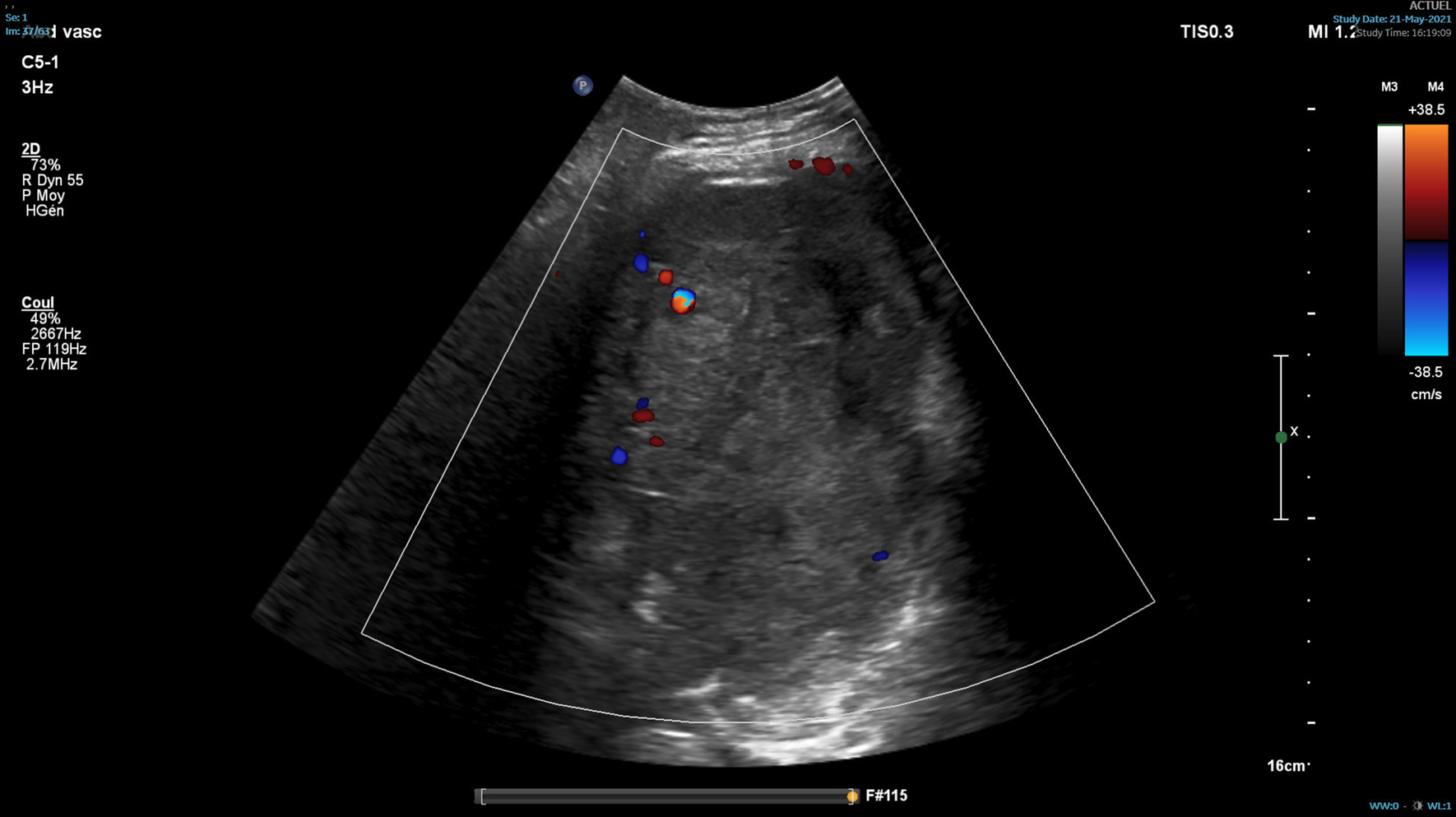 Fig. 8