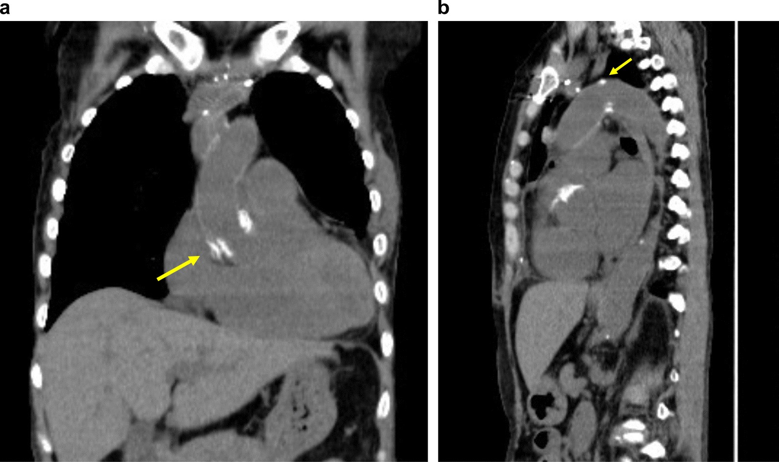 Fig. 6