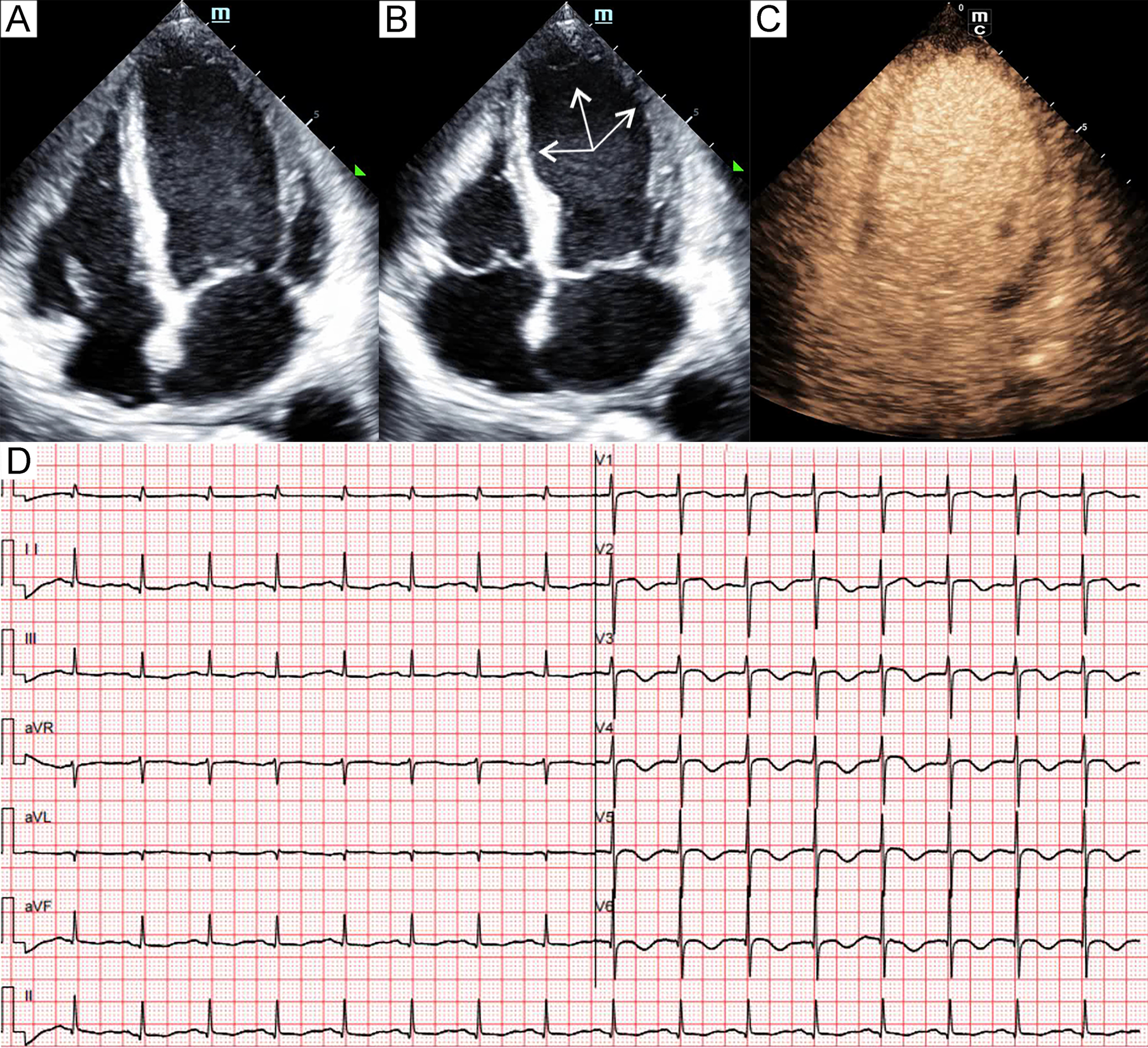 Fig. 2