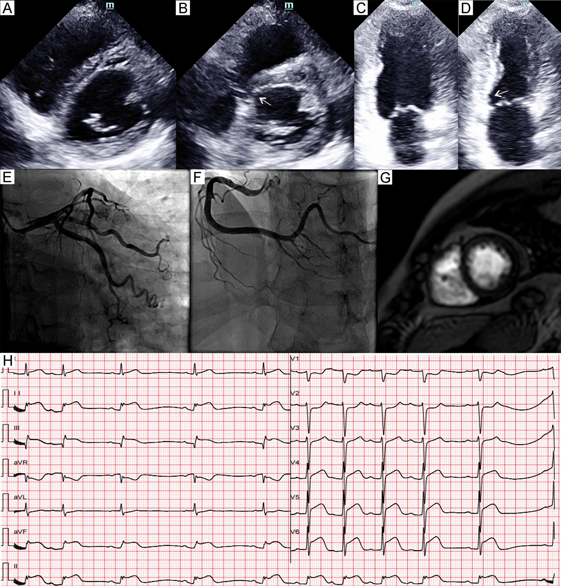 Fig. 6