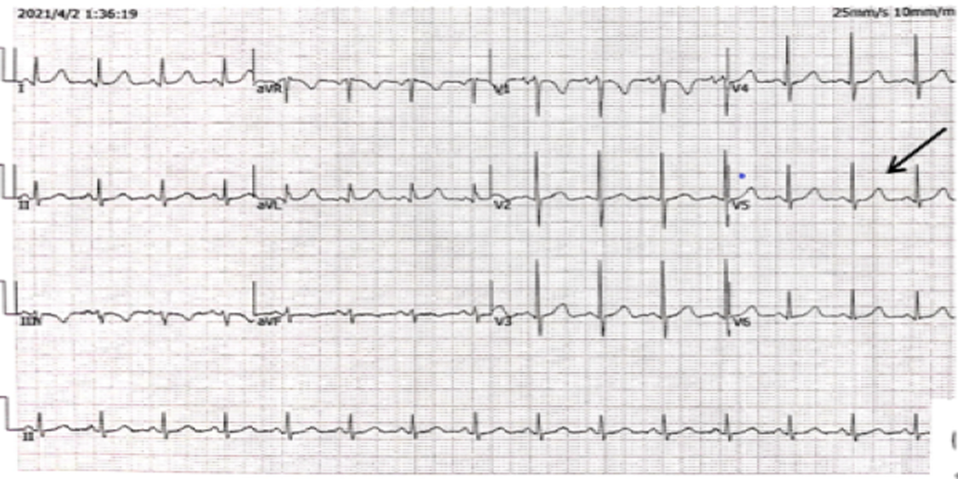 Fig. 3