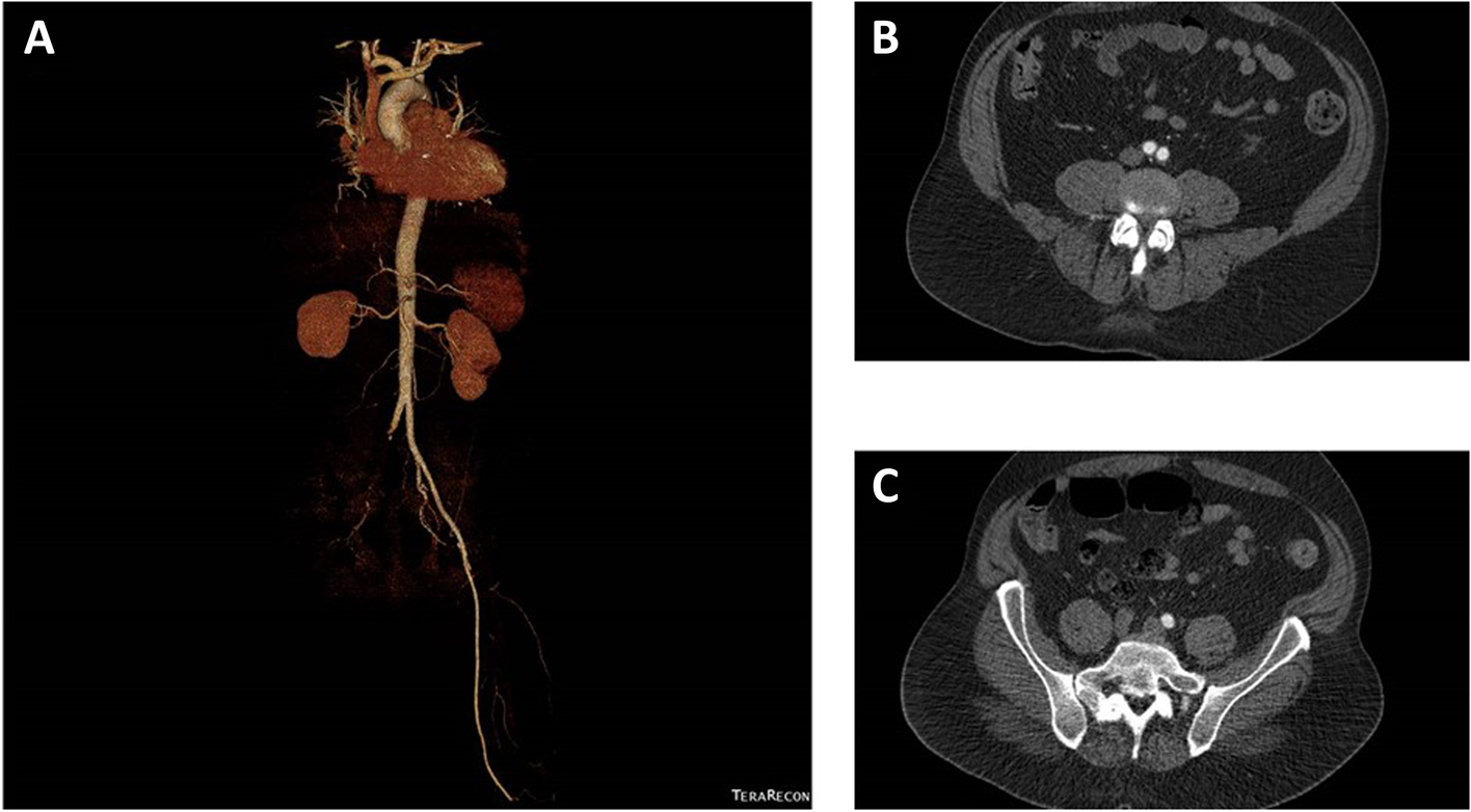 Fig. 1