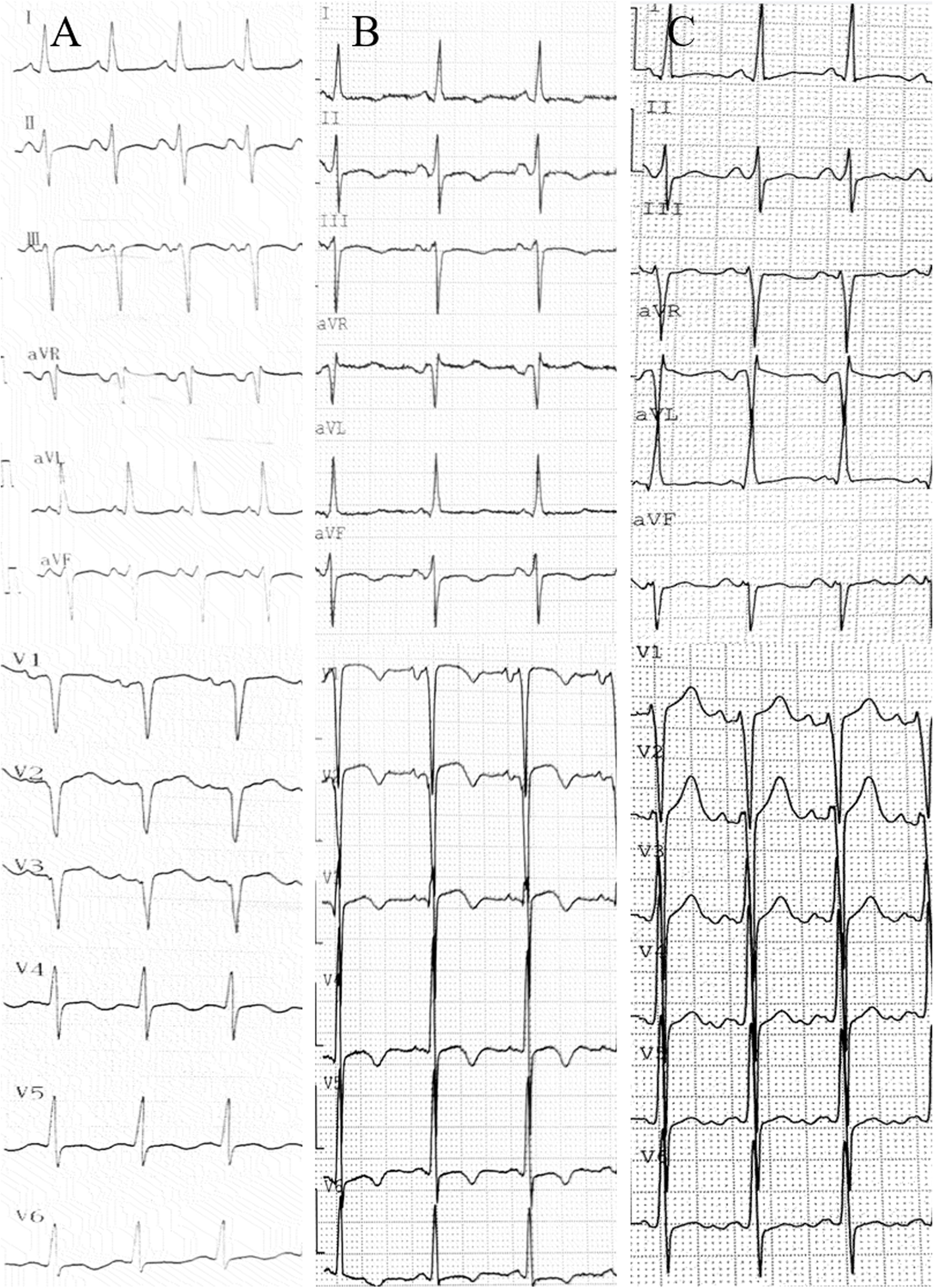 Fig. 1