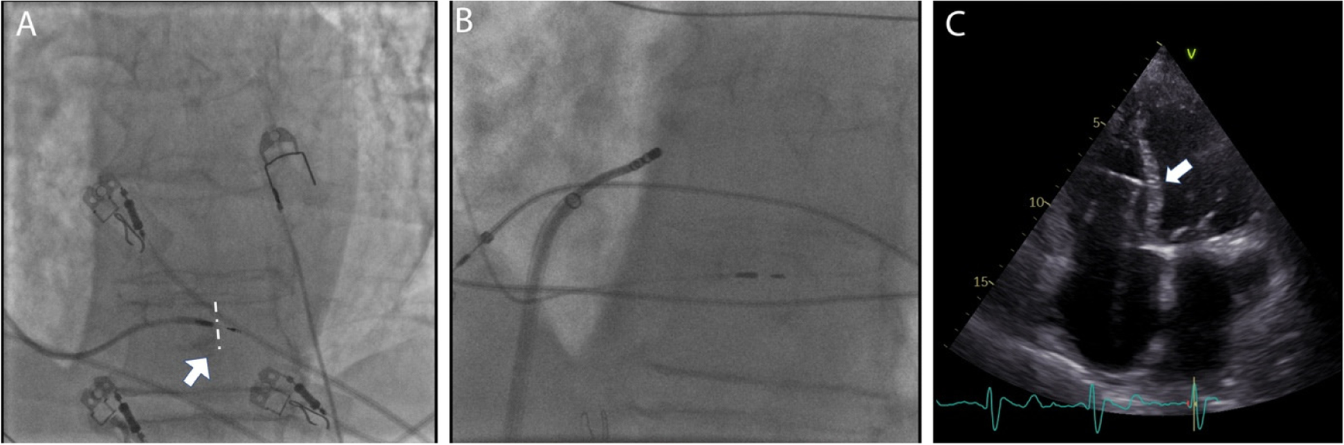 Fig. 3