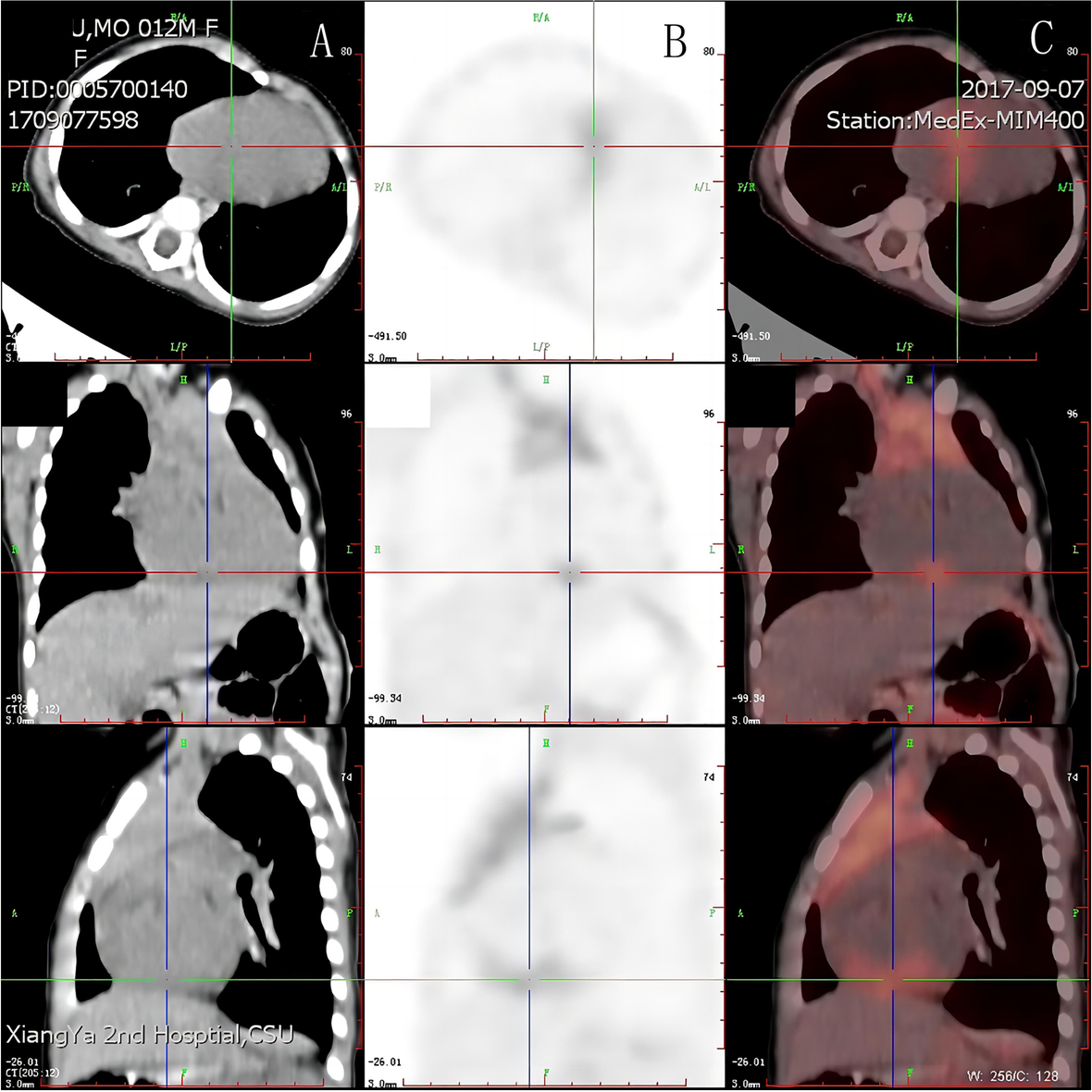 Fig. 2