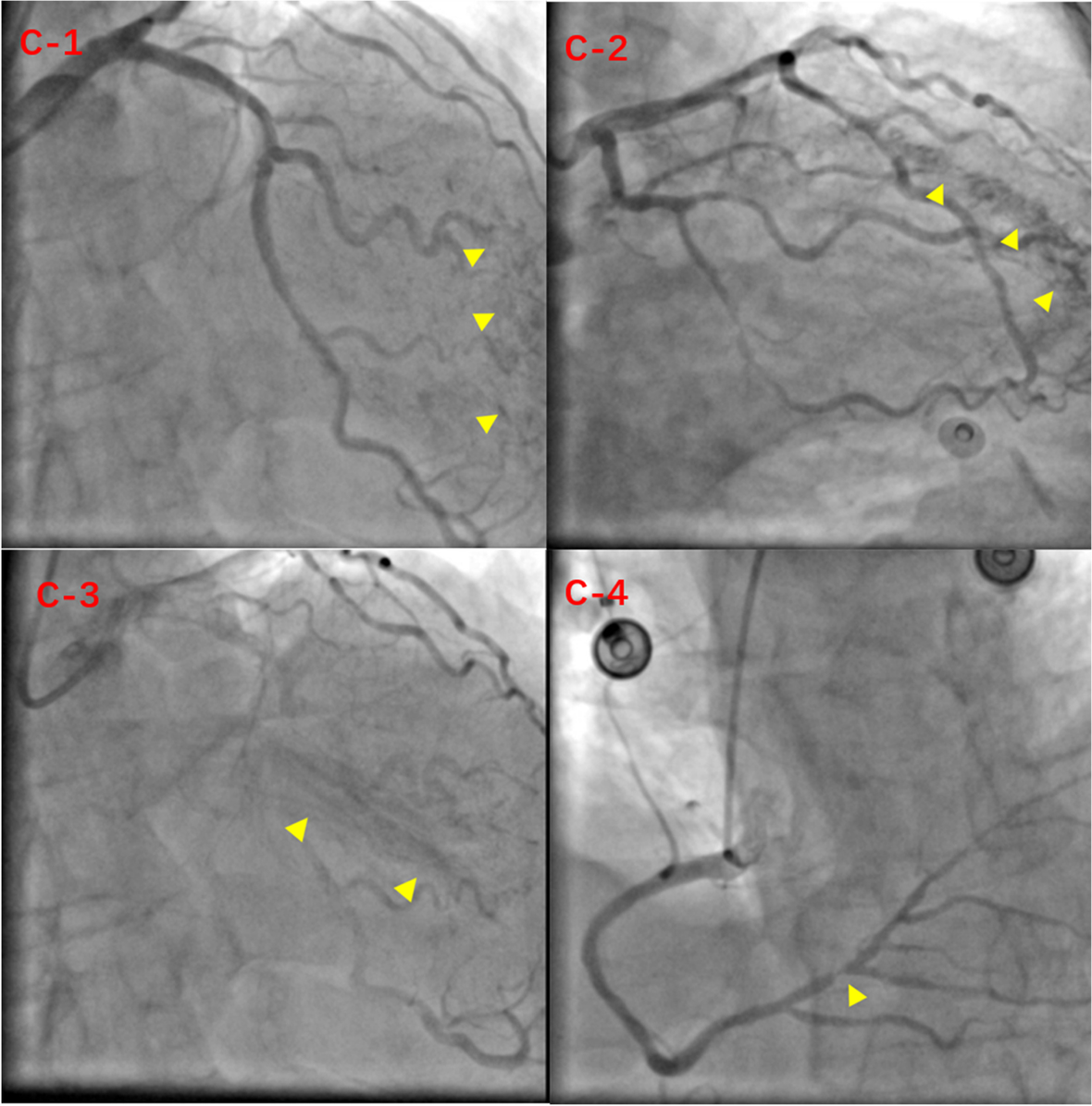 Fig. 3