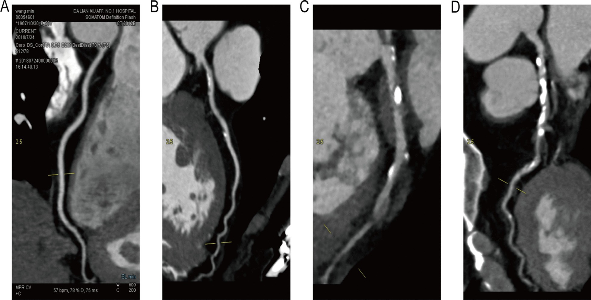 Fig. 2