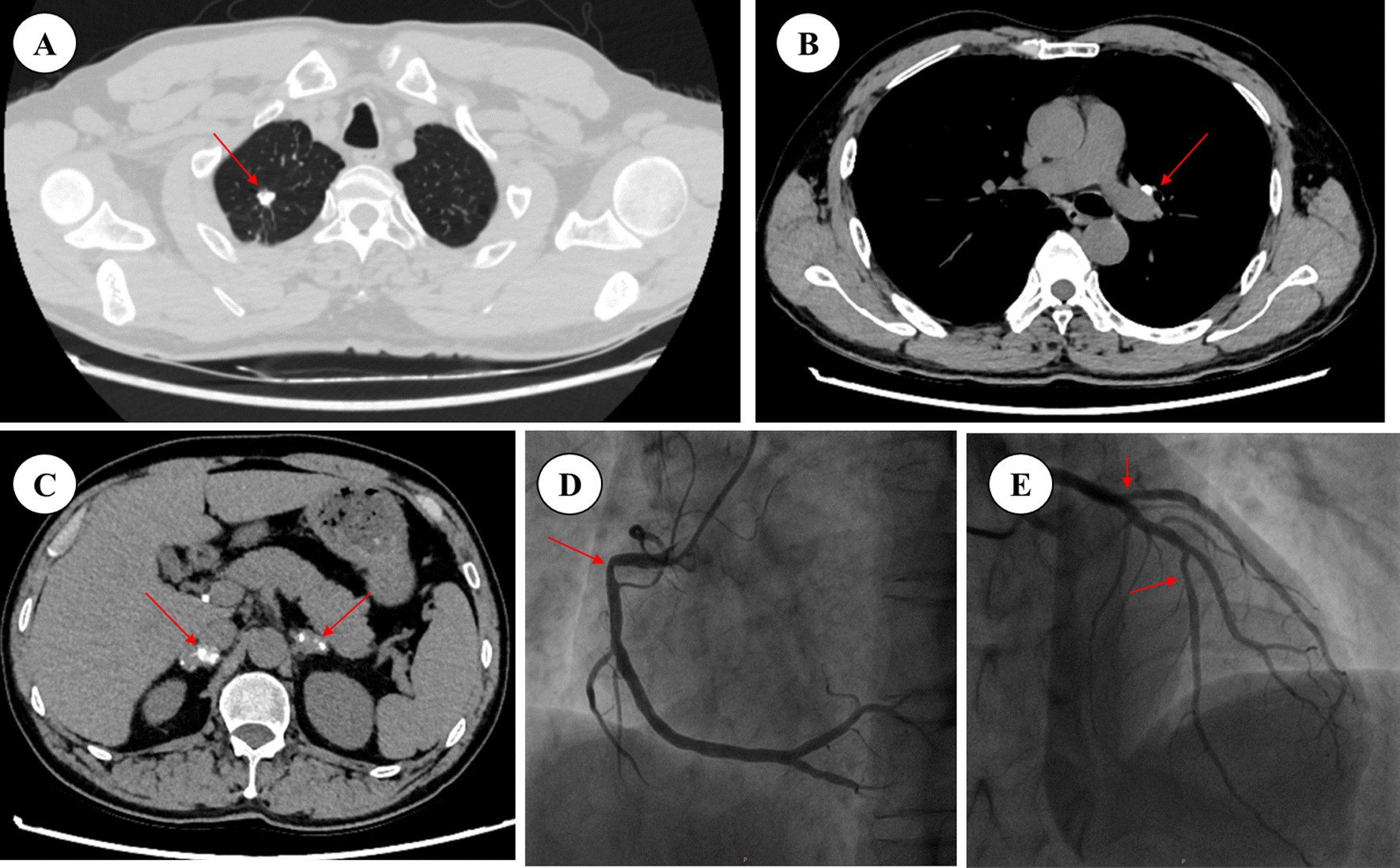 Fig. 4