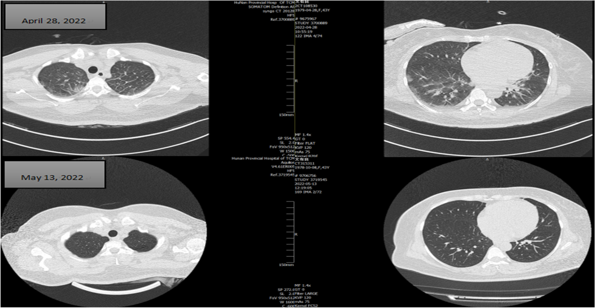 Fig. 4