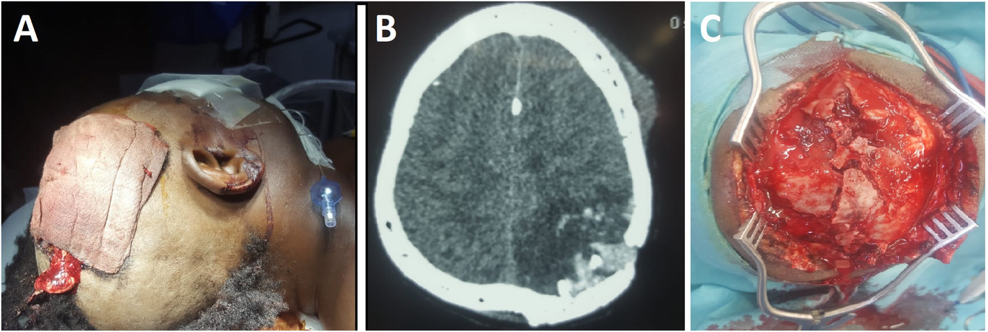 Fig. 3