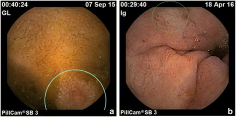 Fig. 3