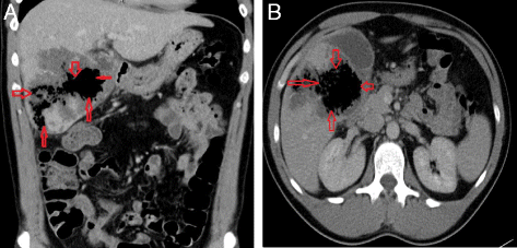 Fig. 5