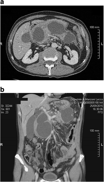 Fig. 1