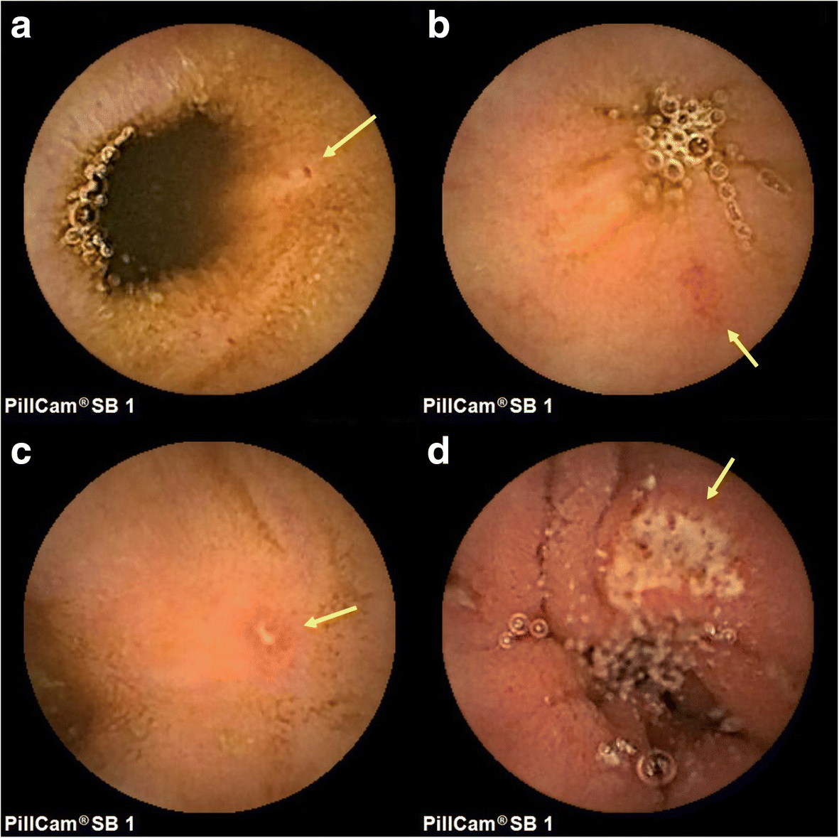 Fig. 1