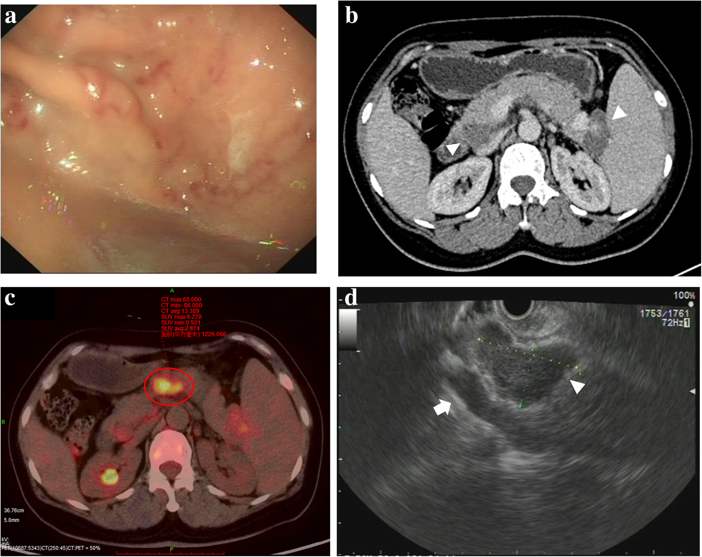 Fig. 1