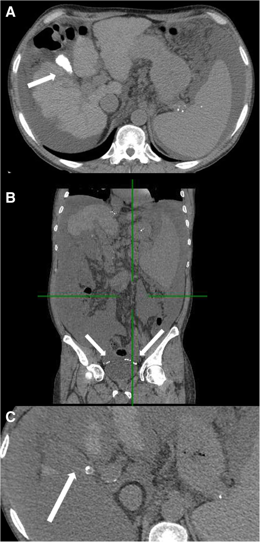 Fig. 1