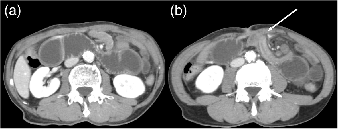 Fig. 1