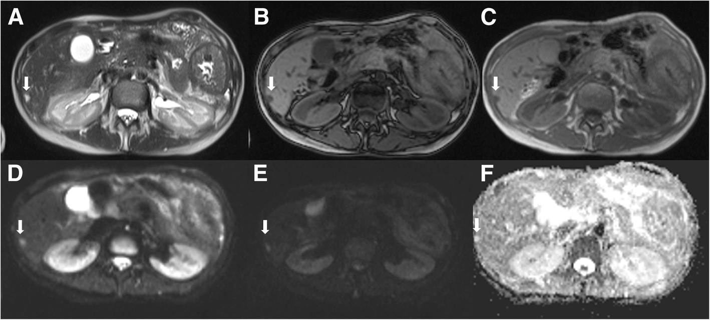 Fig. 5