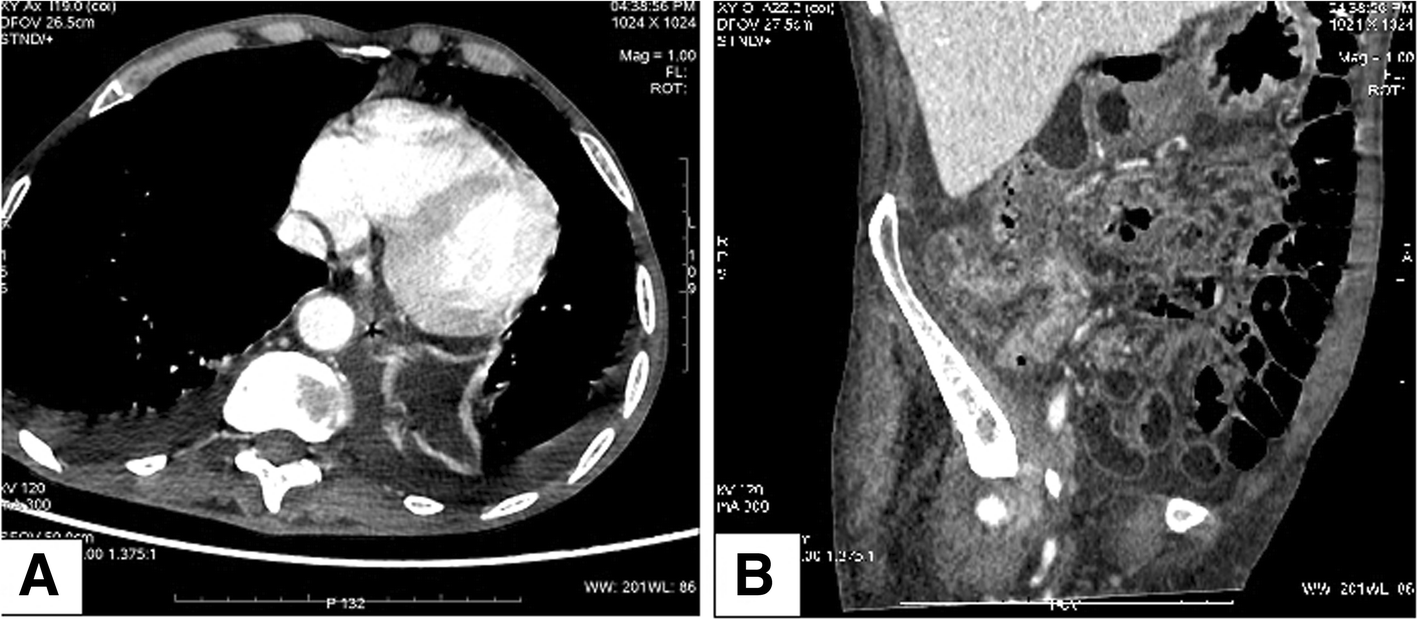 Fig. 1