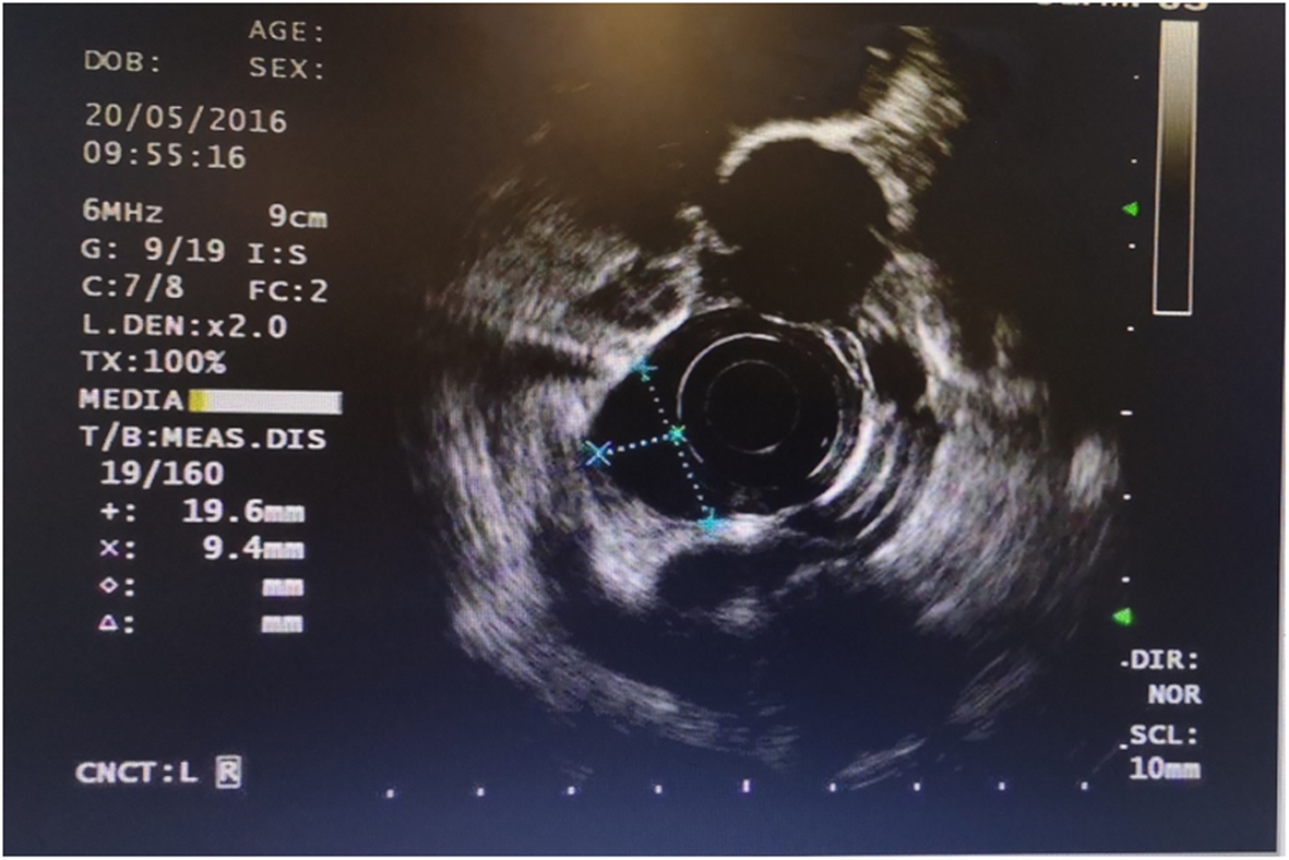 Fig. 2