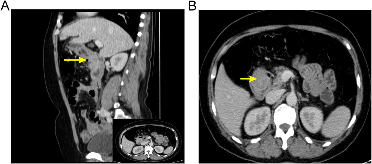 Fig. 1