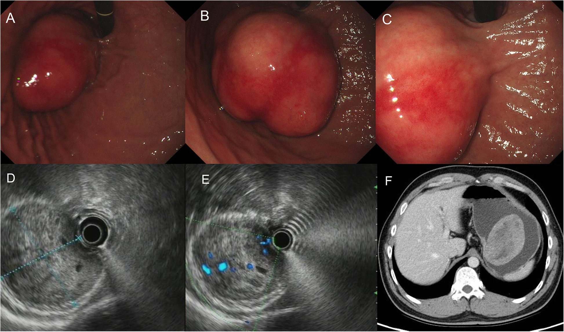 Fig. 1