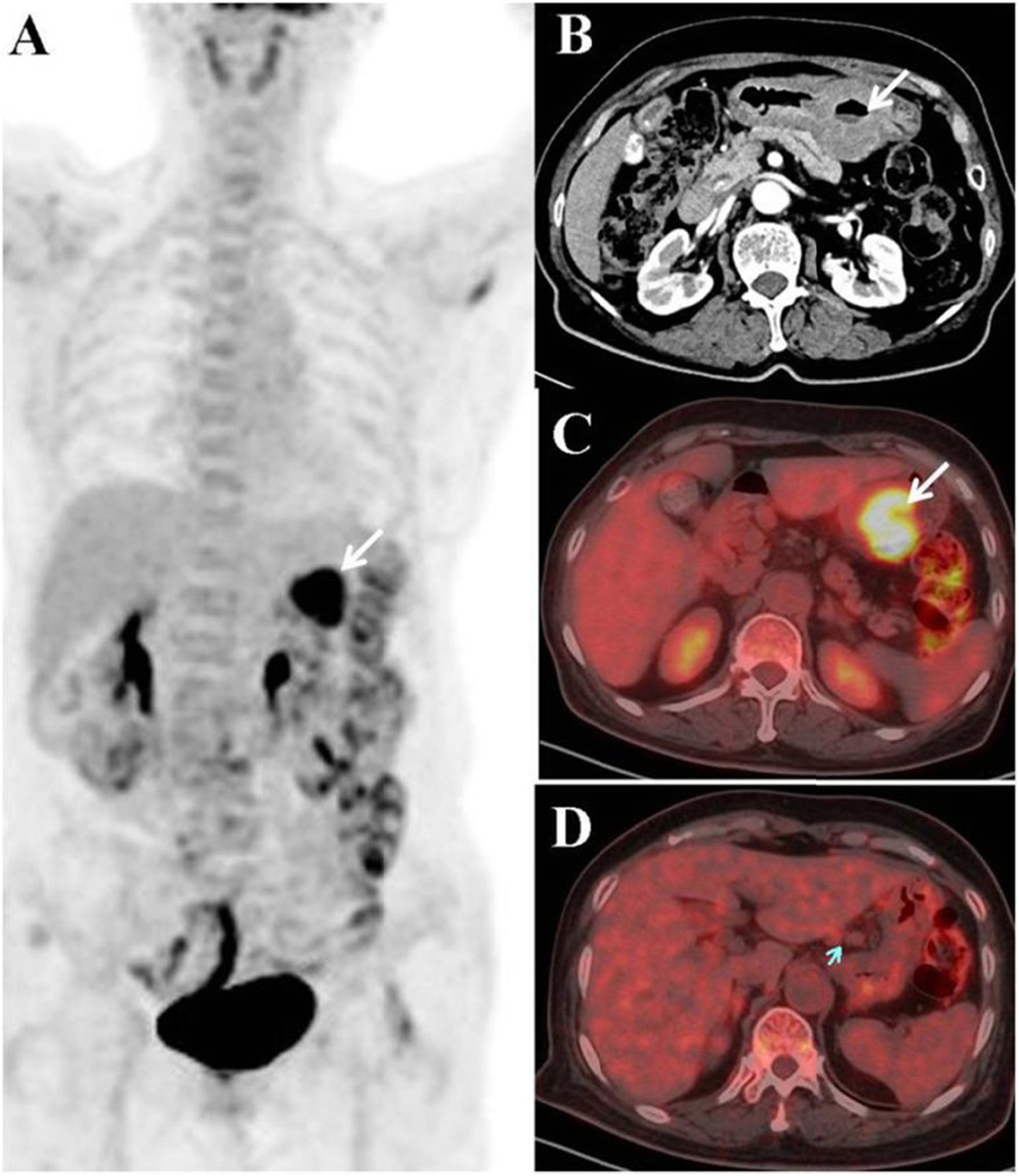 Fig. 1