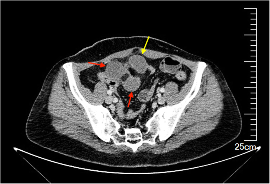 Fig. 1