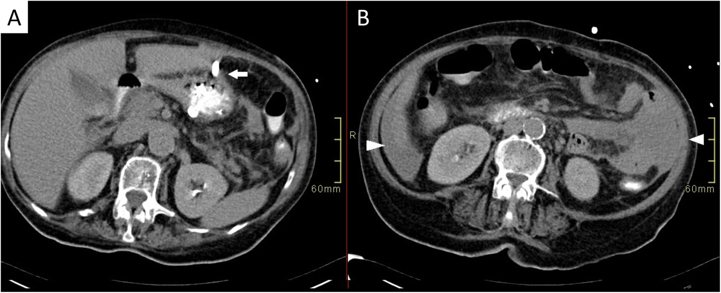 Fig. 3