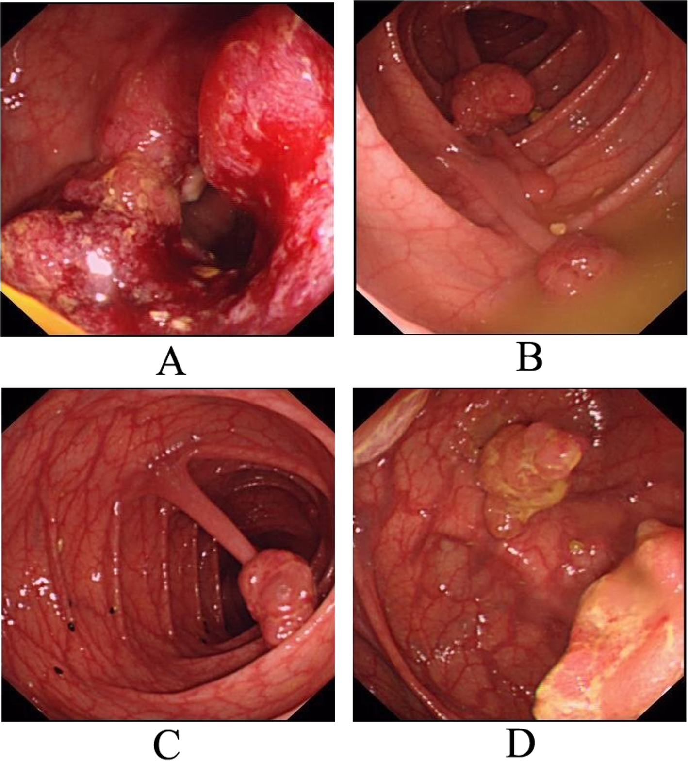 Fig. 1