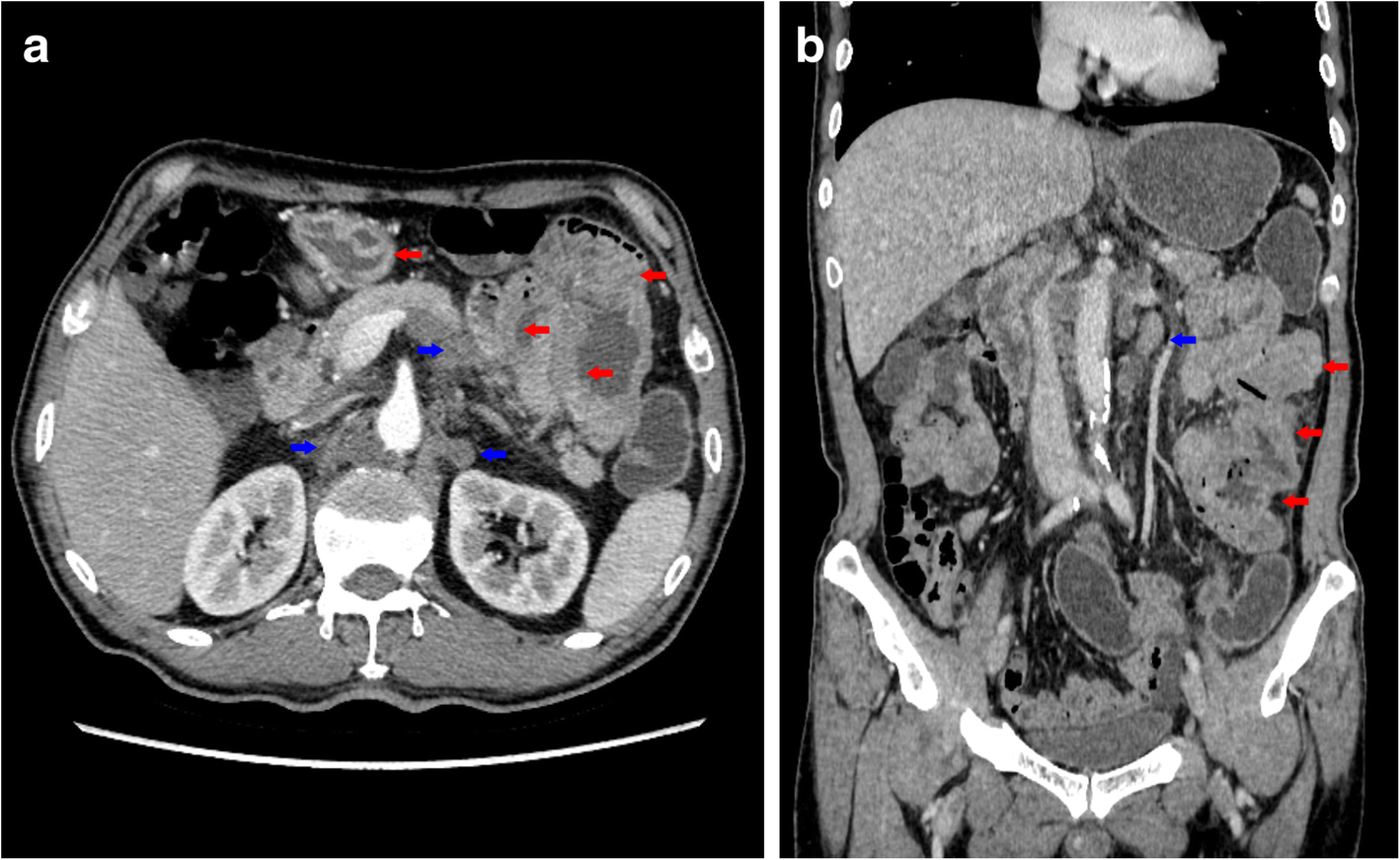 Fig. 2