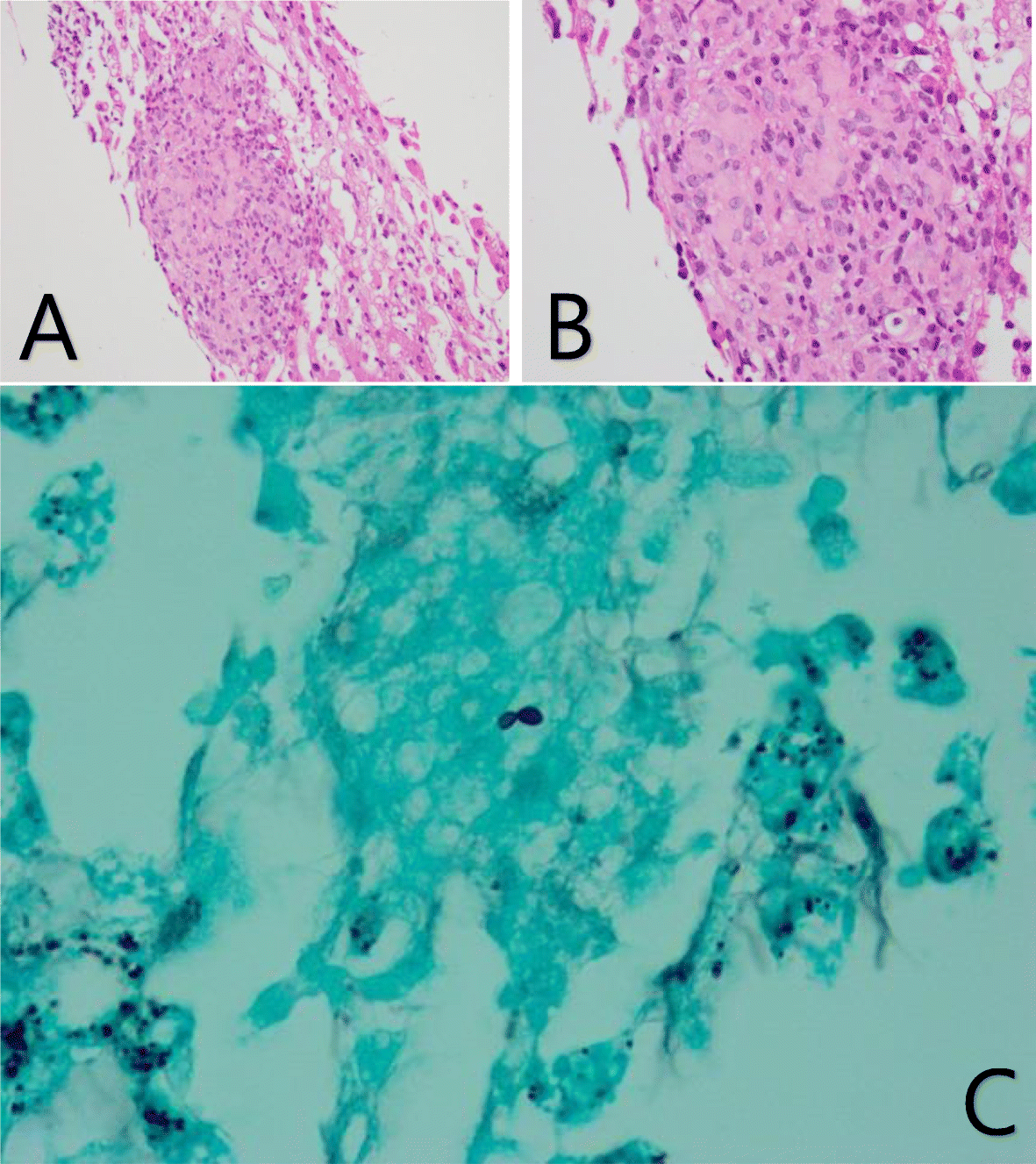 Fig. 1