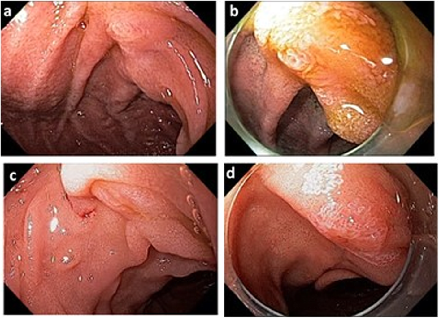 Fig. 1