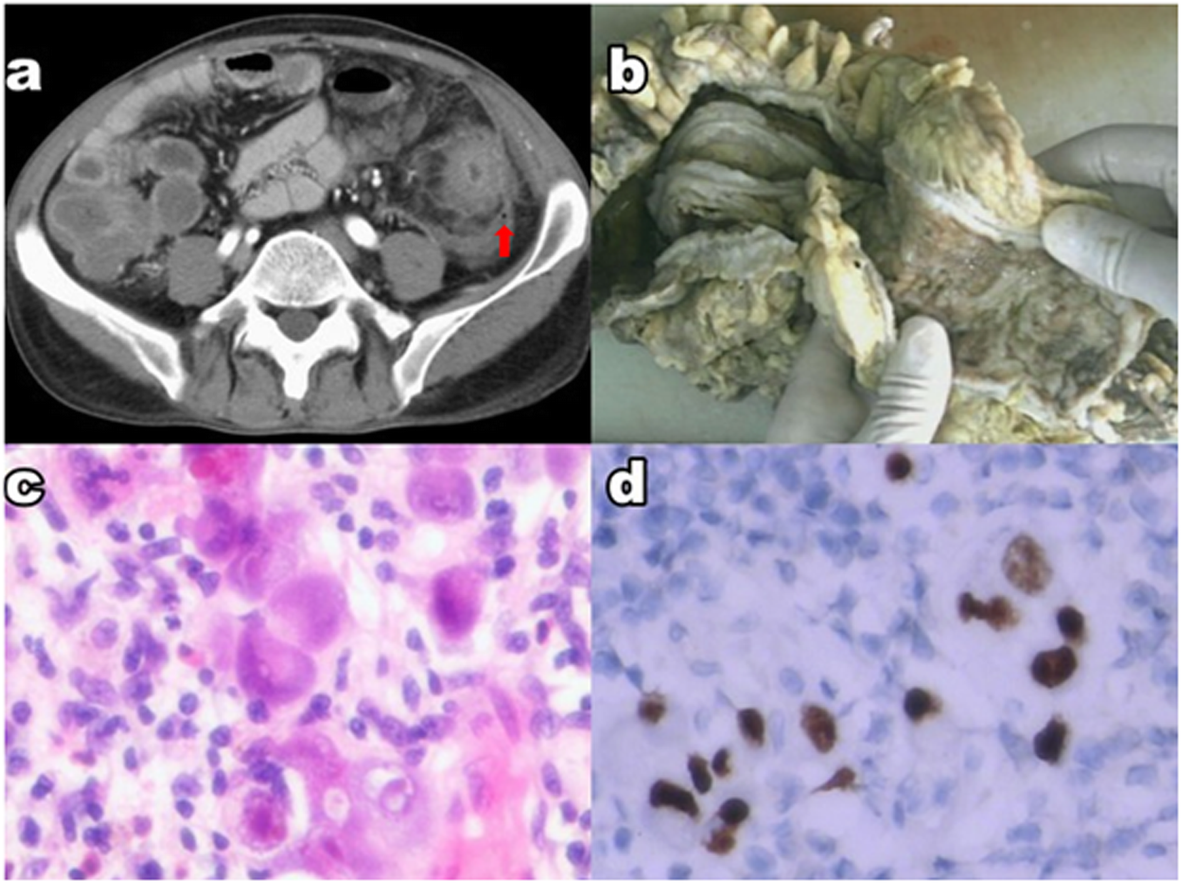 Fig. 1