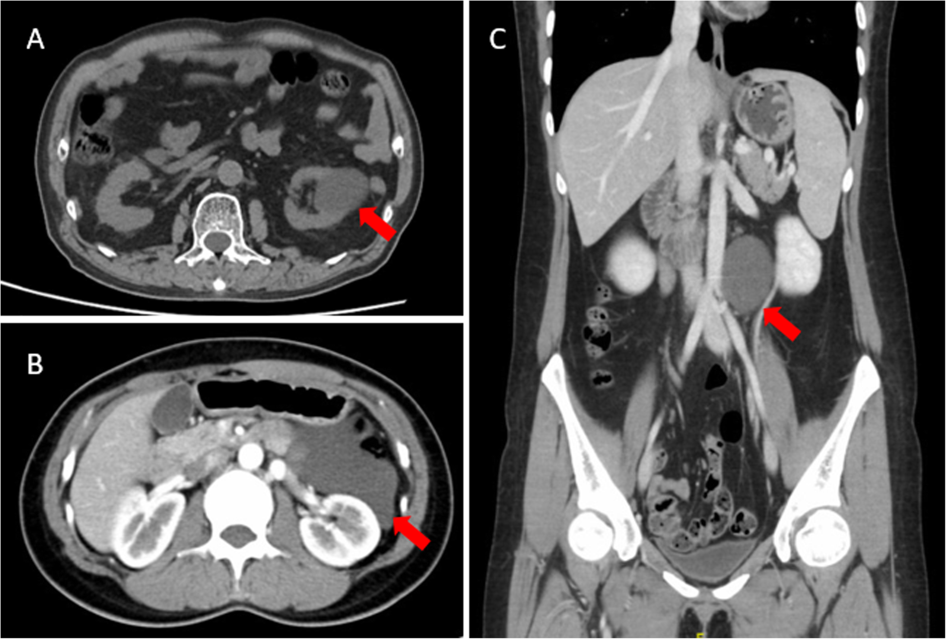 Fig. 1