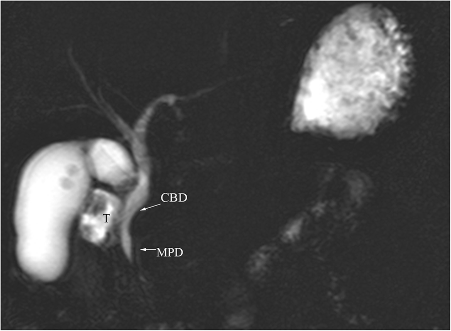 Fig. 11