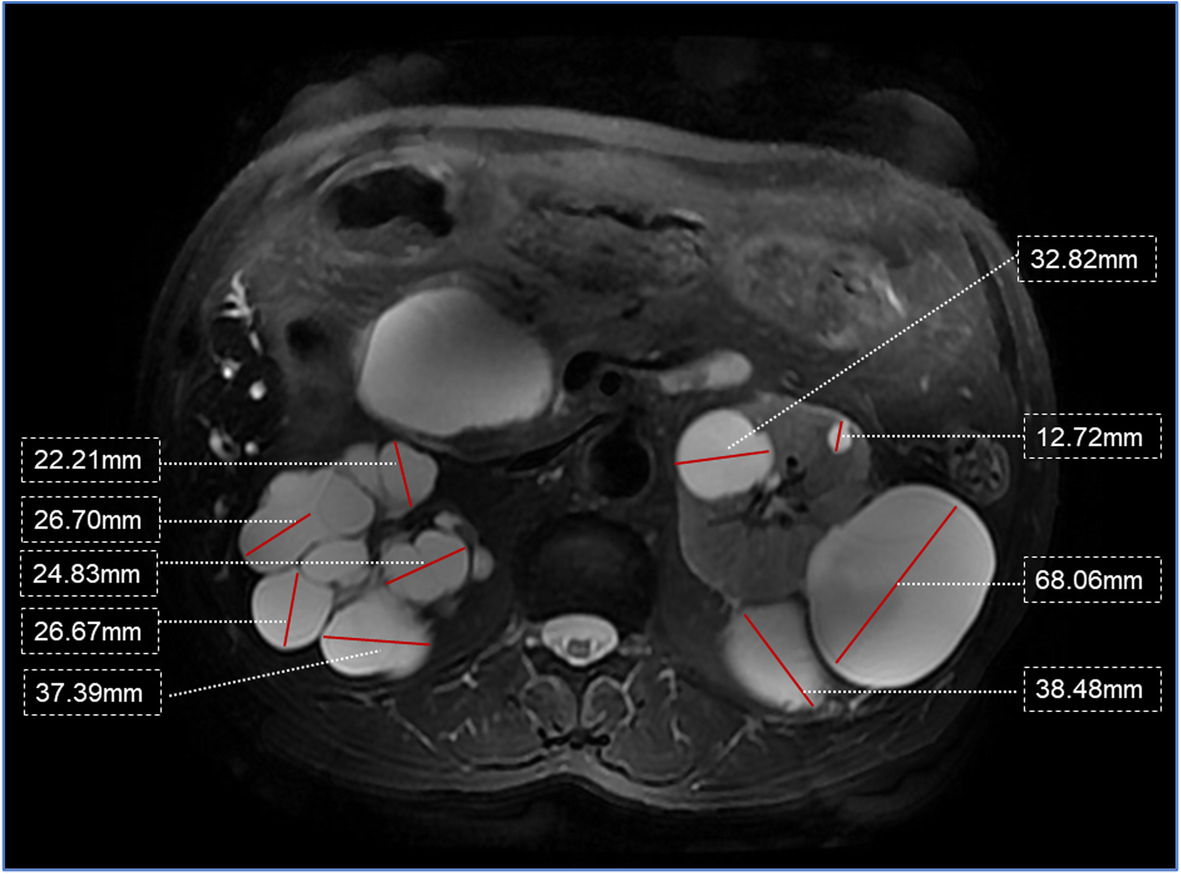 Fig. 2