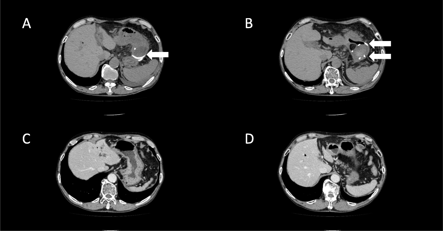 Fig. 3