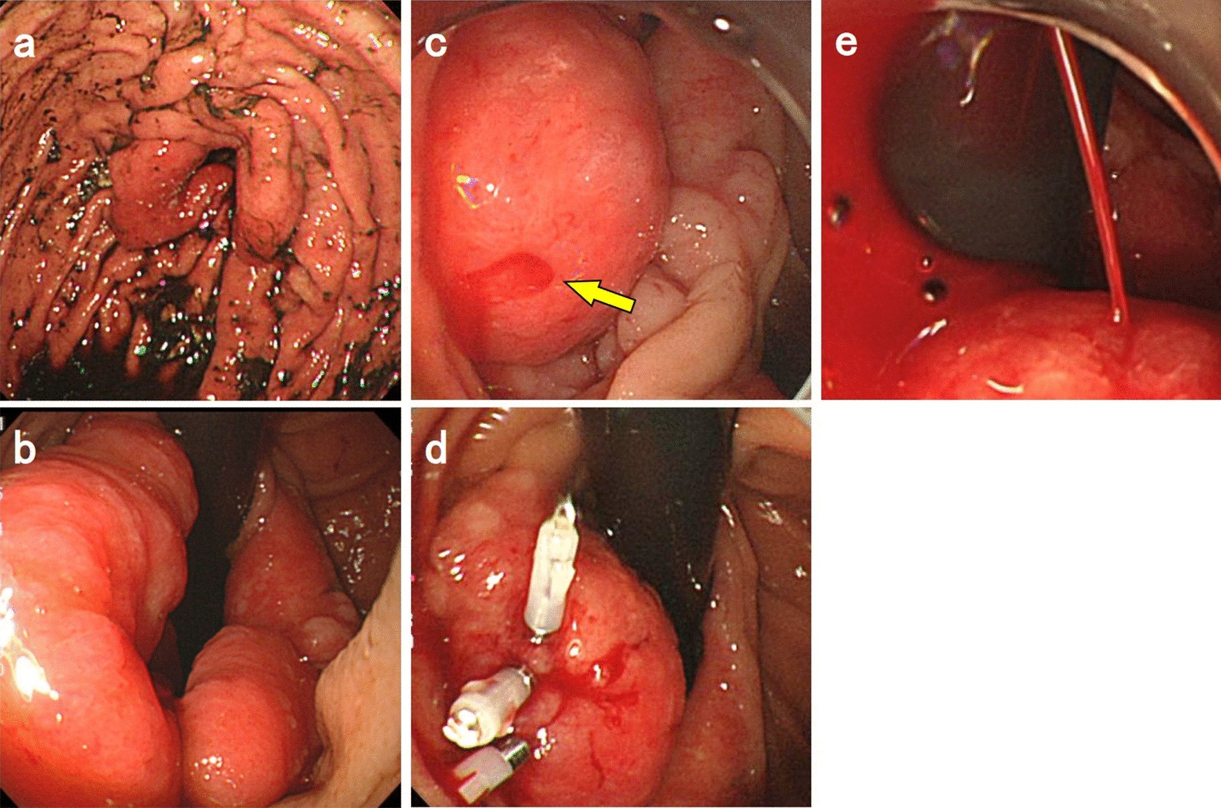 Fig. 1