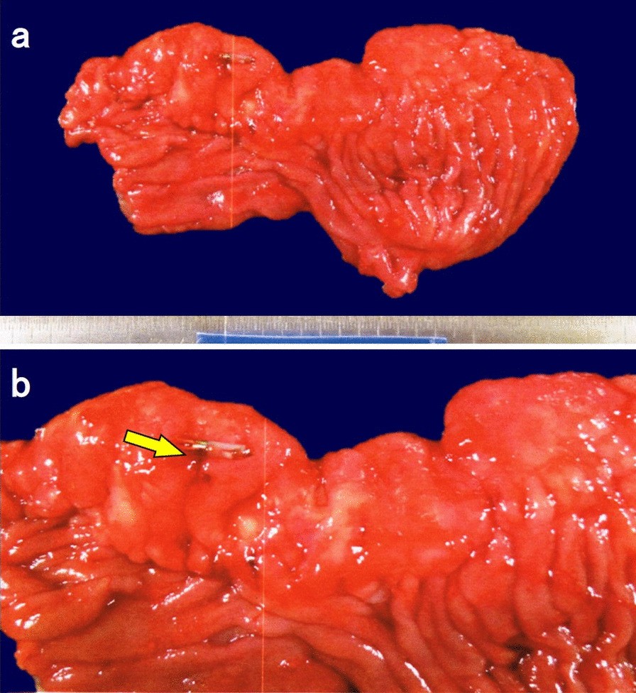 Fig. 2